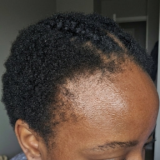 Denise W after